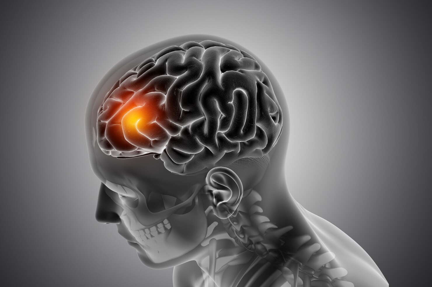 Medelis Healthcare Neurology