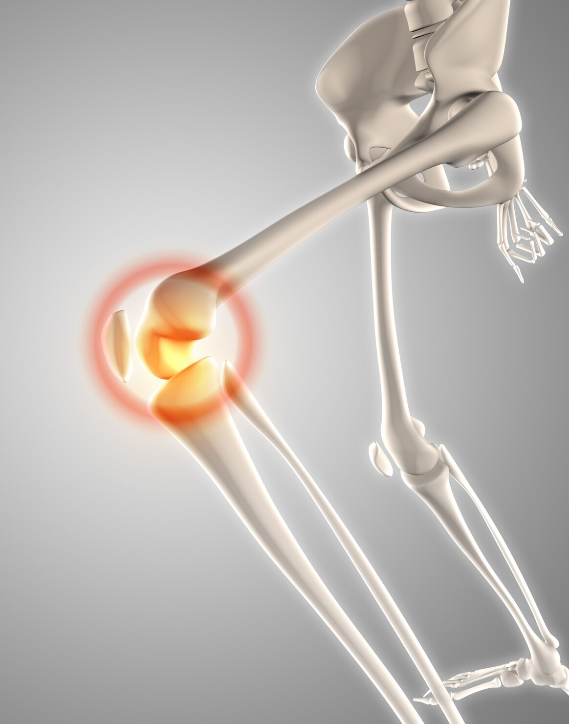 Medelis Healthcare Orthopaedic Range